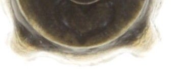 20290092818